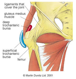 Hip Bursitis: Exercises